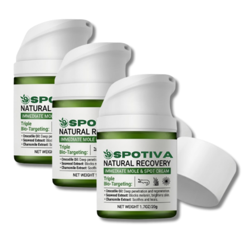 Spotiva